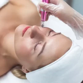 microneedling